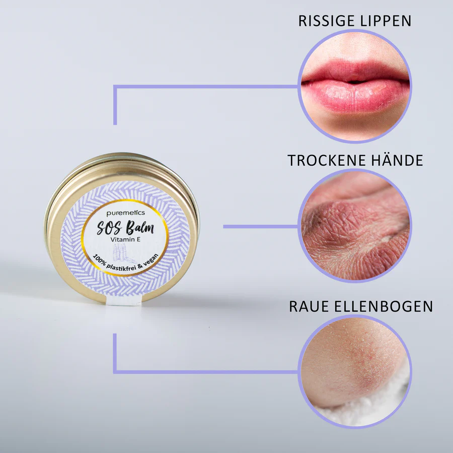 SOS BALM 'VITAMIN E'